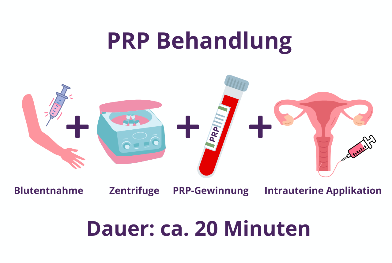 Ablauf der intrauterinen PRP-Behandlung: Aus einer kleinen Blutprobe wird plättchenreiches Plasma gewonnen, aufbereitet und schonend in die Gebärmutter eingebracht – ein natürlicher Weg, die Einnistungschancen zu verbessern.
